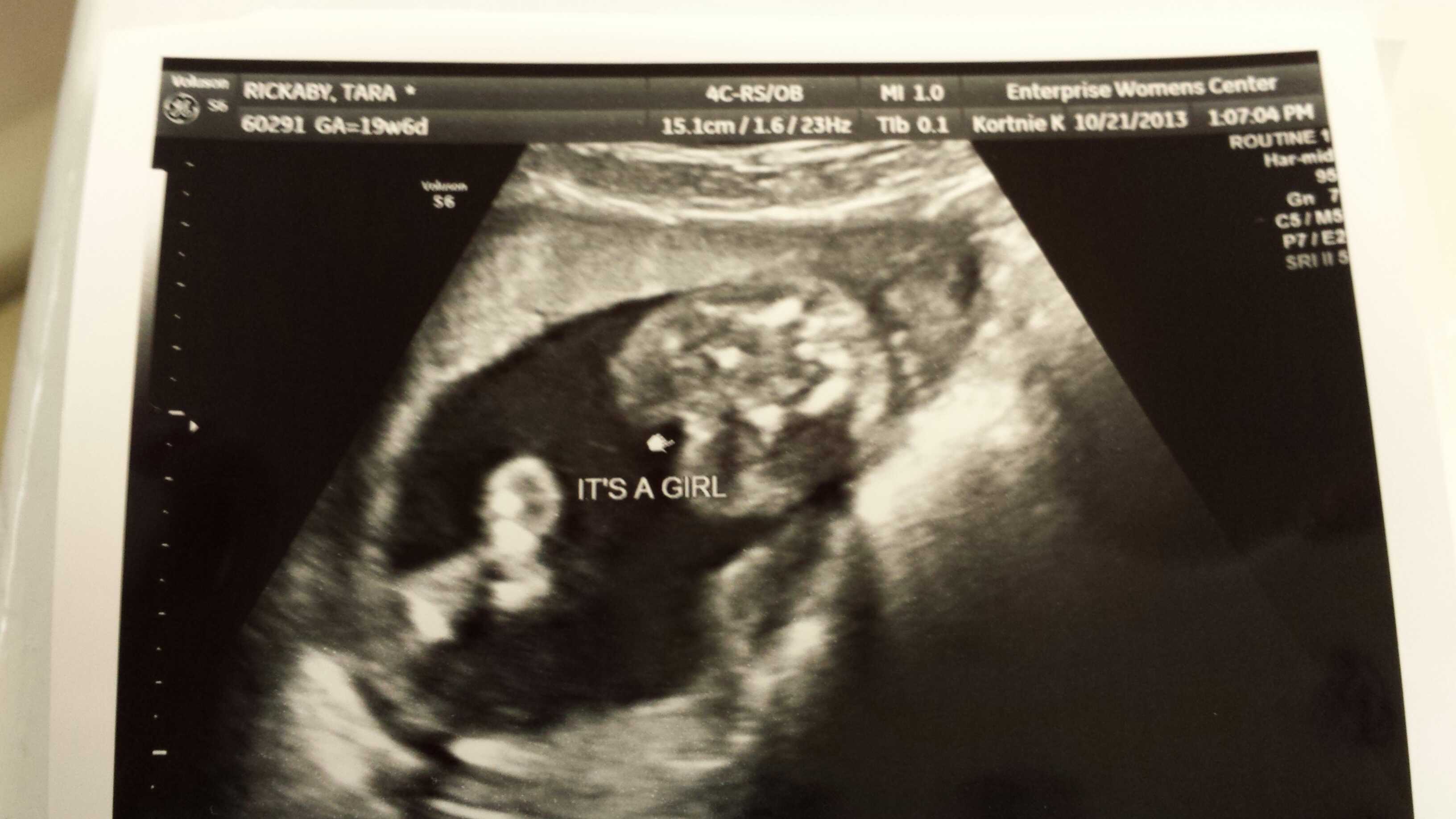 Tara during her pregnancy with Chloe