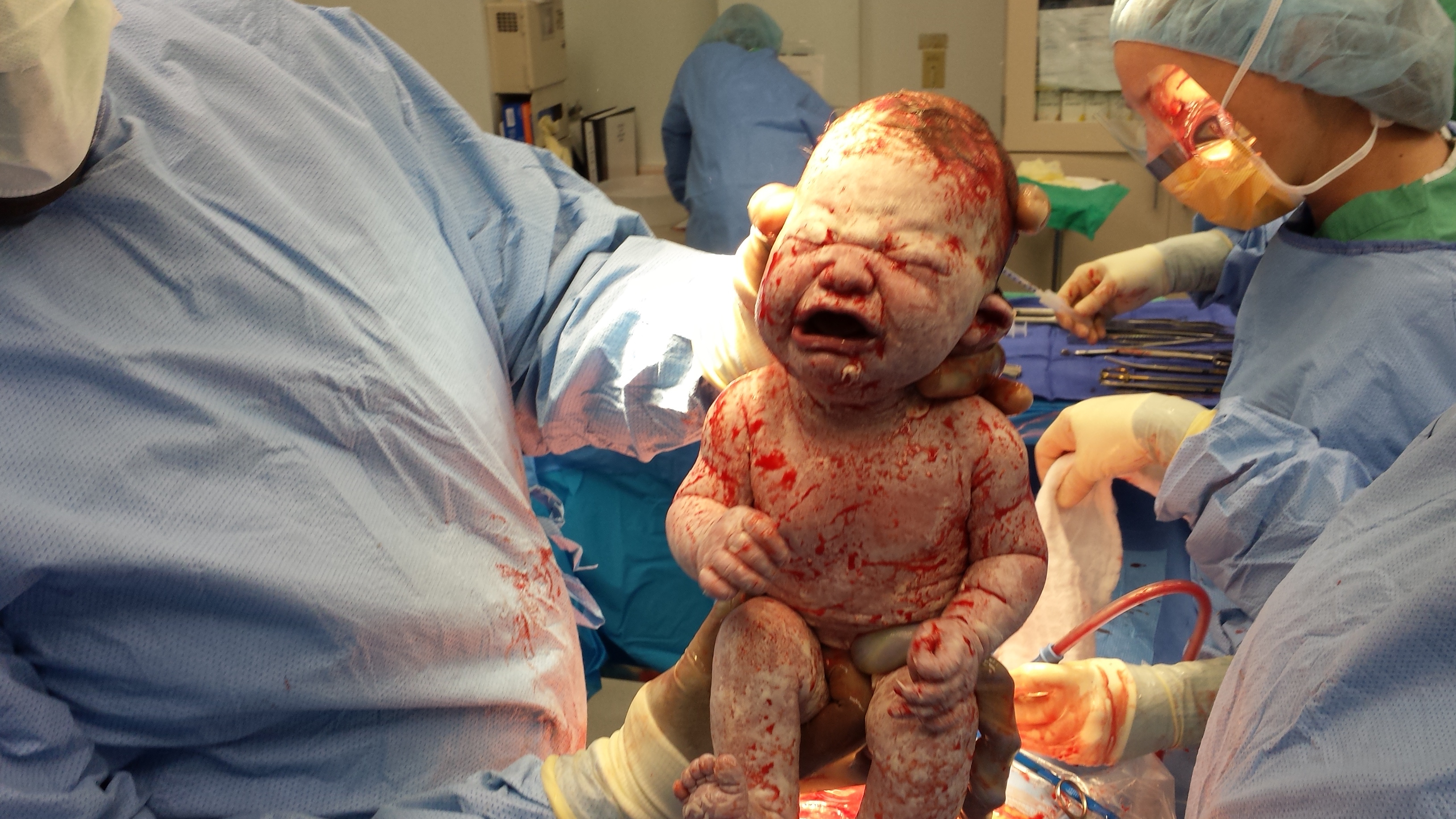 Dr. Griffin holding newborn Chloe in the operating room